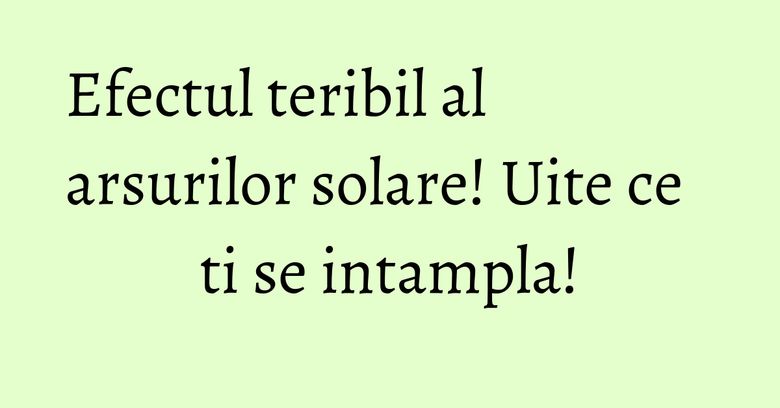 Efectul teribil al arsurilor solare! Uite ce ti se intampla! Efectul teribil al arsurilor solare! Uite ce ti se intampla!