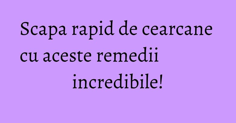 Scapa rapid de cearcane cu aceste remedii incredibile!