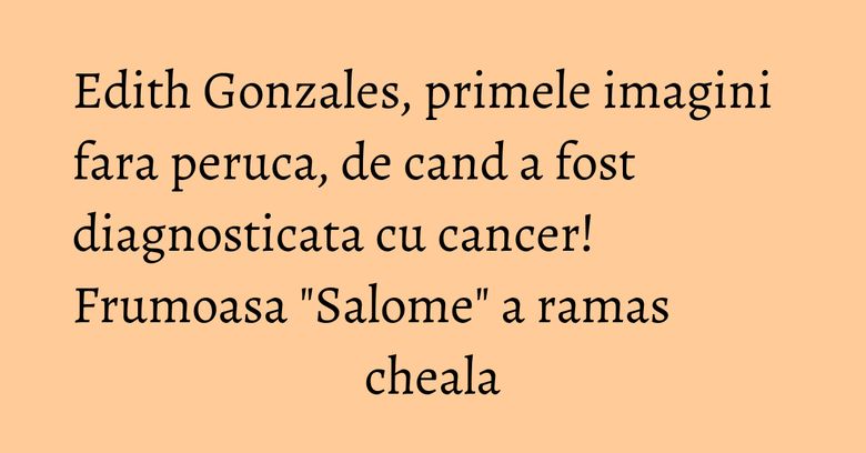 Edith Gonzales, primele imagini fara peruca, de cand a fost diagnosticata cu cancer! Frumoasa "Salome" a ramas cheala Edith Gonzales, primele imagini fara peruca, de cand a fost diagnosticata cu cancer! Frumoasa "Salome" a ramas cheala