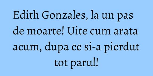 Edith Gonzales, la un pas de moarte! Uite cum arata acum, dupa ce si-a pierdut tot parul!