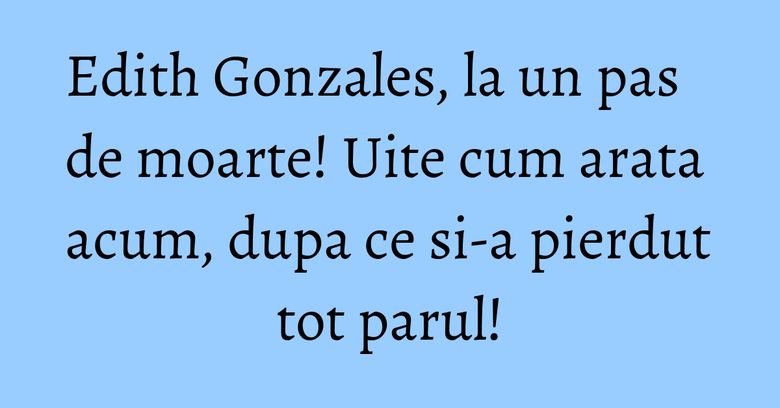 Edith Gonzales, la un pas de moarte! Uite cum arata acum, dupa ce si-a pierdut tot parul! Edith Gonzales, la un pas de moarte! Uite cum arata acum, dupa ce si-a pierdut tot parul!