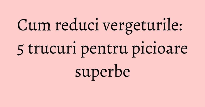 Cum reduci vergeturile: 5 trucuri pentru picioare superbe
