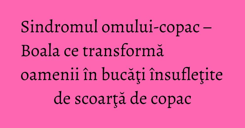 Sindromul omului-copac – Boala ce transformă oamenii în bucăţi însufleţite de scoarţă de copac Sindromul omului-copac – Boala ce transformă oamenii în bucăţi însufleţite de scoarţă de copac