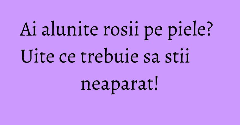 Ai alunite rosii pe piele? Uite ce trebuie sa stii neaparat! Ai alunite rosii pe piele? Uite ce trebuie sa stii neaparat!