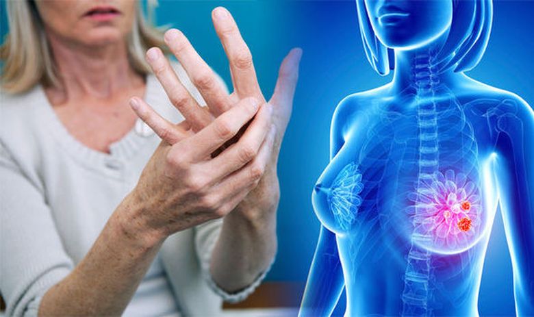 10 mituri despre cancerul la sân pe care medicii le aud frecvent