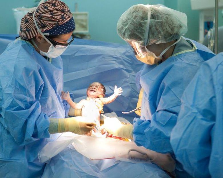 Operaţia de cezariană schimbă evoluţia corpului uman Operaţia de cezariană schimbă evoluţia corpului uman