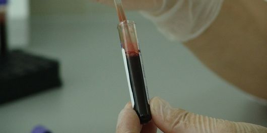 Primele simptome care apar în toate tipurile de cancer! Atenție mare la ele!