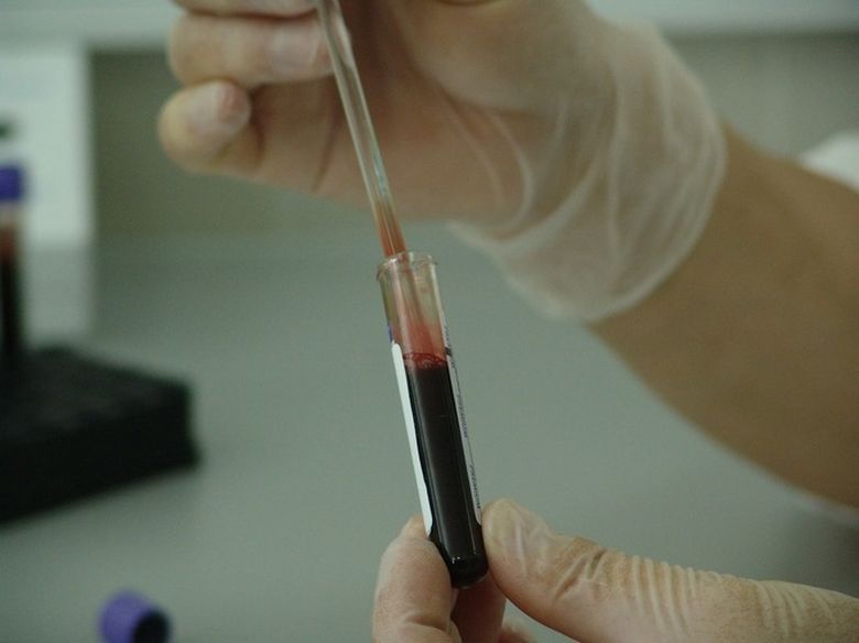 Primele simptome care apar în toate tipurile de cancer! Atenție mare la ele! Primele simptome care apar în toate tipurile de cancer! Atenție mare la ele!