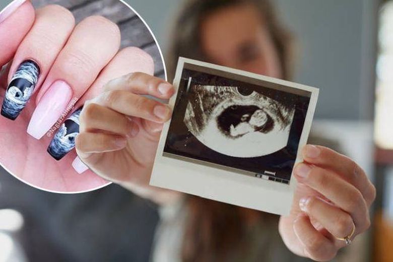 Cea mai noua tendinta pentru femeile insarcinate. Manichiura cu ecografie pe unghii