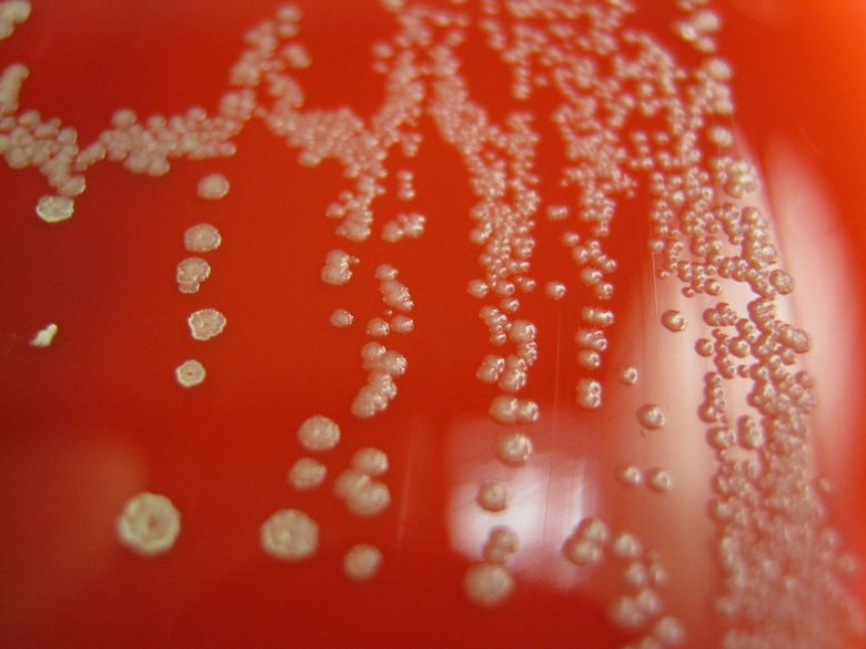 Bacteria din gură și cancerul colorectal, descoperirea care arată de ce unele cancere evoluează mai rapid Bacteria din gură și cancerul colorectal, descoperirea care arată de ce unele cancere evoluează mai rapid