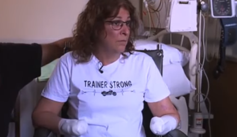 VIDEO. Infecția rară care a lăsat o femeie fără membre! Motivul infectării este unul extrem de banal