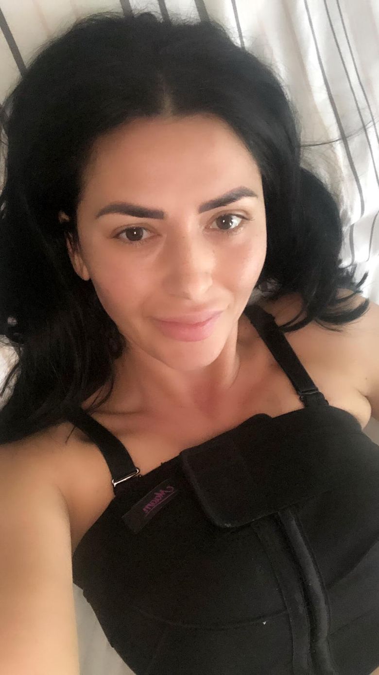 I-au explodat silicoanele! Raluca Dumitru de la Survivor a fost operată de urgență acum ceva timp!