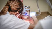 5 probleme frecvente care îți pot da dureri dentare 