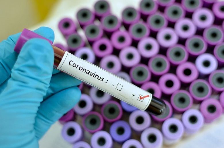 Încă un caz de coronavirus în Capitală și altul la Iași. Bilanţul îmbolnăvirilor a ajuns la 31 Încă un caz de coronavirus în Capitală și altul la Iași. Bilanţul îmbolnăvirilor a ajuns la 31