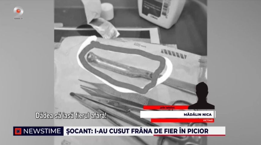 spitalul urlati, frana de bicicleta, caz socant