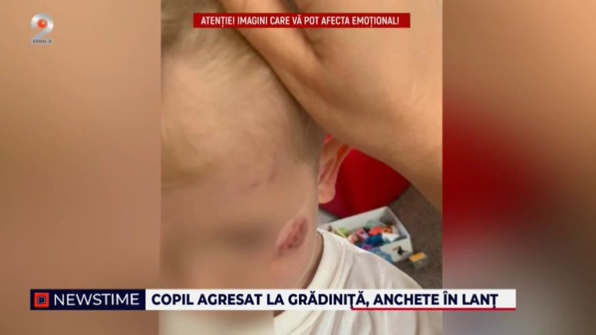 brasov, gradinita privata, copil muscat, protectia copilului