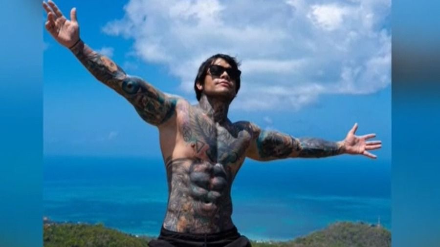 influencer columbian, operatie pentru inaltime, operatie inedita