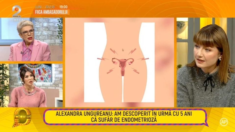 endometrioza, alexandra ungureanu, alexandra ungureanu boala, follow us 