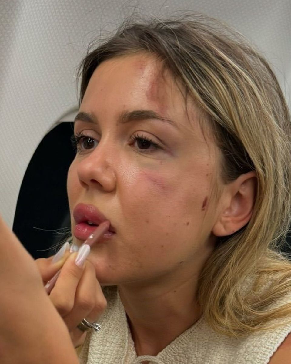 Cum a reacționat Dana Roba, după accidentul lui Emily Burghelea