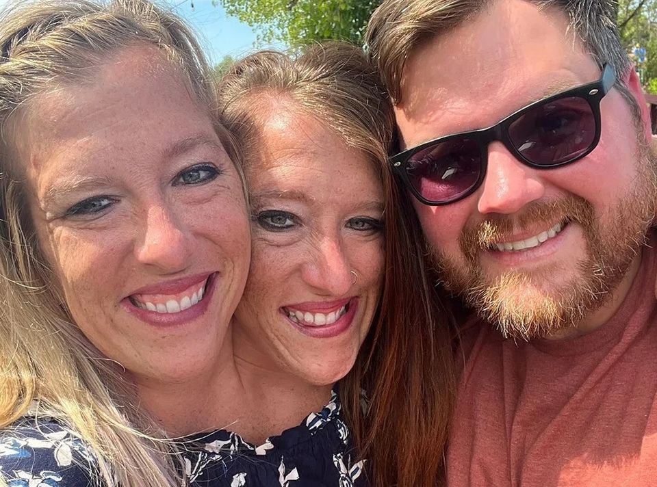 abby si brittany hensel 