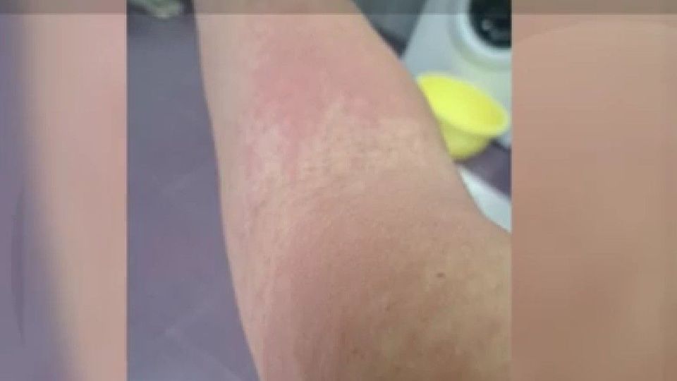 O femeie a fost la un pas de moarte, după ce a cumpărat o cremă cu mercur de 500 de lei