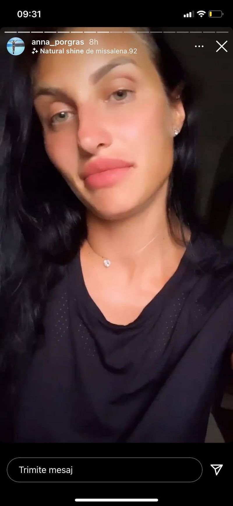 Ana Porgras, mesaj emoționant pentru Zanni după eliminarea de la Survivor România