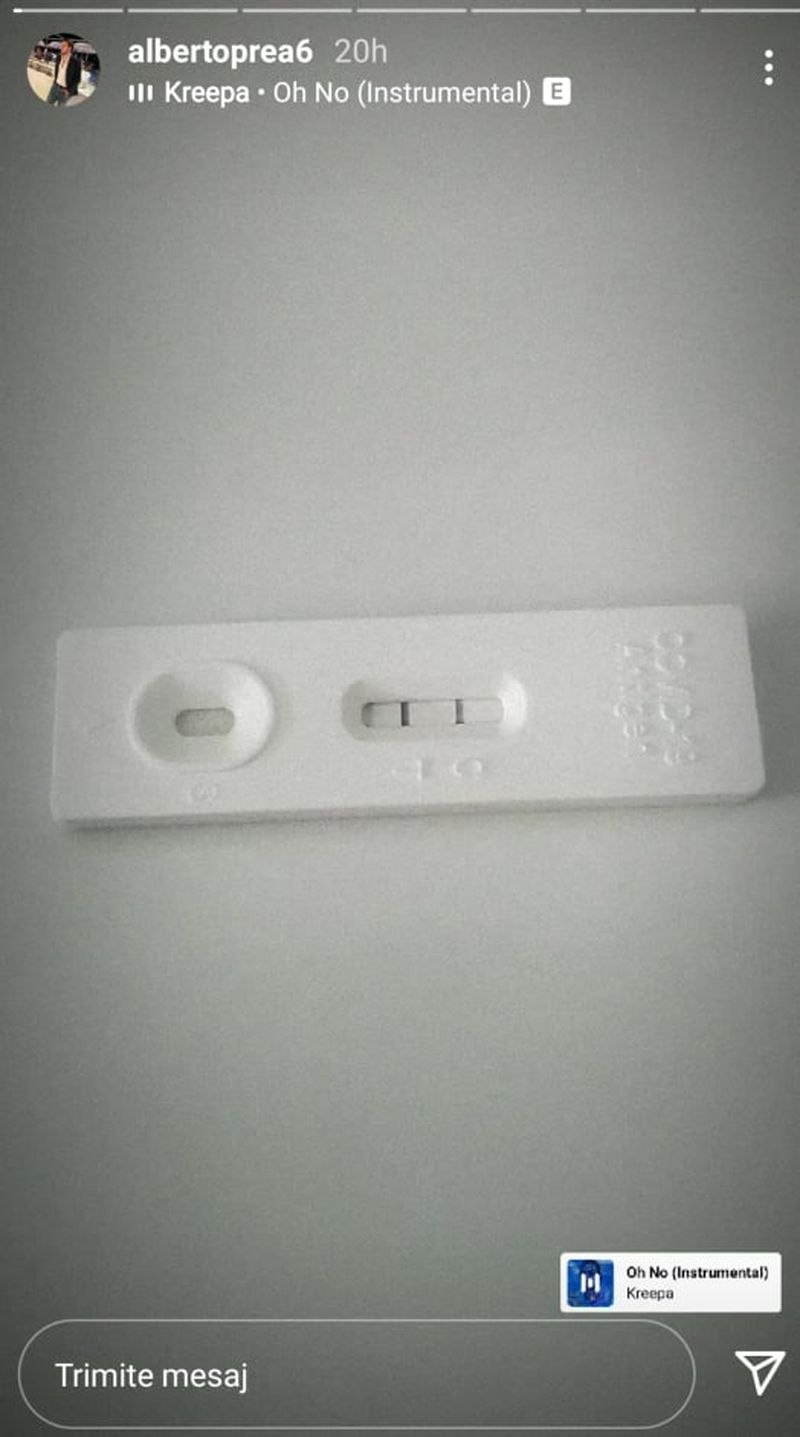 Albert Oprea, fostul concurent de la ”Survivor România”, infectat cu COVID-19