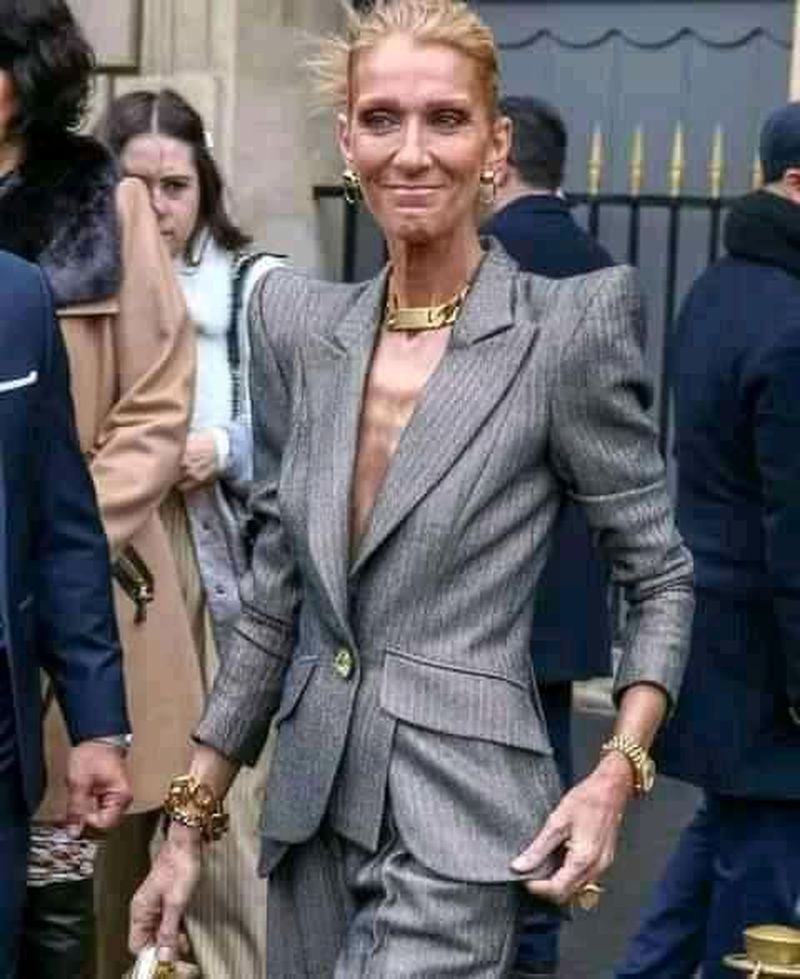 Celine Dion, de nerecunoscut. Celebra cântăreaţă suferă de o boală cumplită