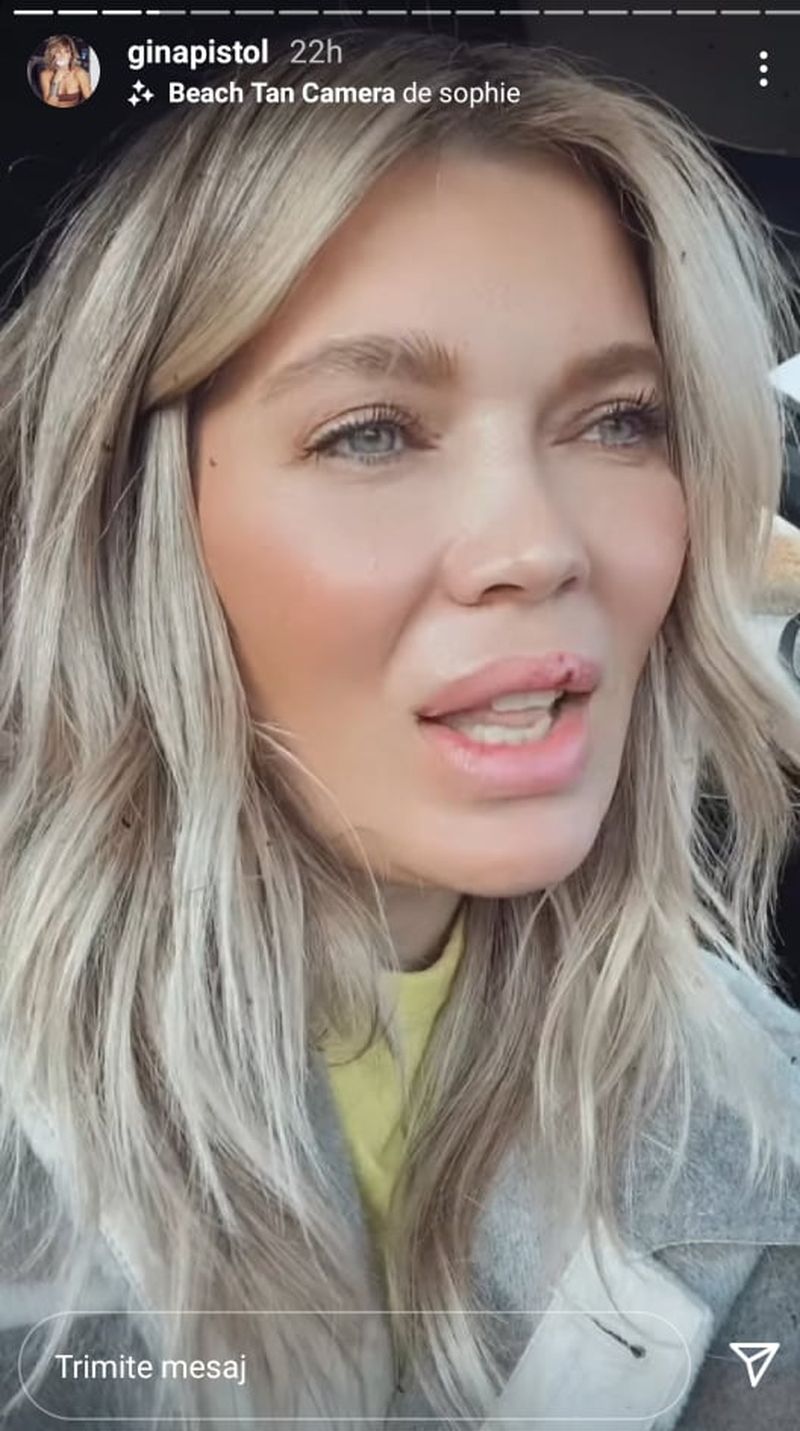 Gina Pistol, noi probleme de sănătate! Iubita lui Smiley le-a cerut ajutorul fanilor din mediul online