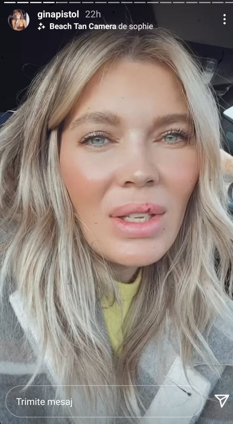 Gina Pistol, noi probleme de sănătate! Iubita lui Smiley le-a cerut ajutorul fanilor din mediul online