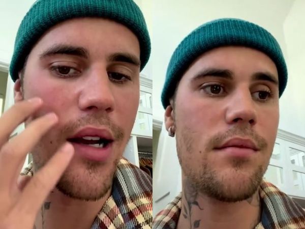 VIDEO: Justin Bieber, nevoit să-și anuleze concertele! Artistul are jumătate de față paralizată: &bdquo;Este destul de grav. Sper că mă &icirc;nțelegeți&rdquo;