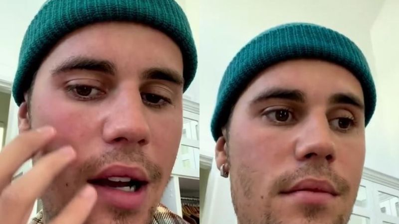 VIDEO: Justin Bieber, nevoit să-și anuleze concertele! Artistul are jumătate de față paralizată: &bdquo;Este destul de grav. Sper că mă &icirc;nțelegeți&rdquo;