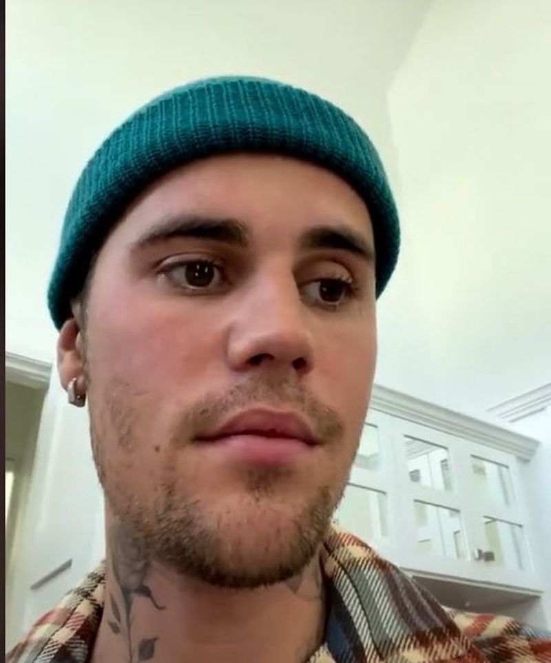 Justin Bieber are jumătate de față paralizată