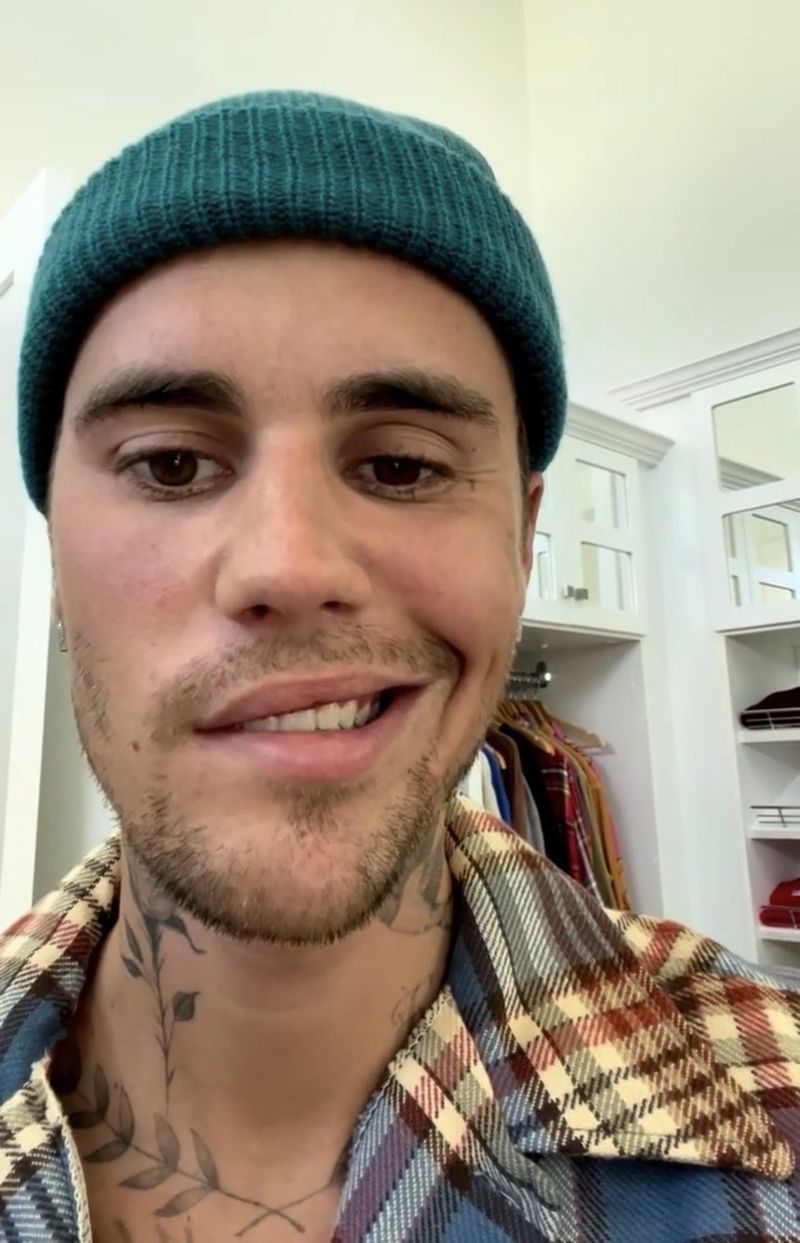 Justin Bieber are jumătate de față paralizată