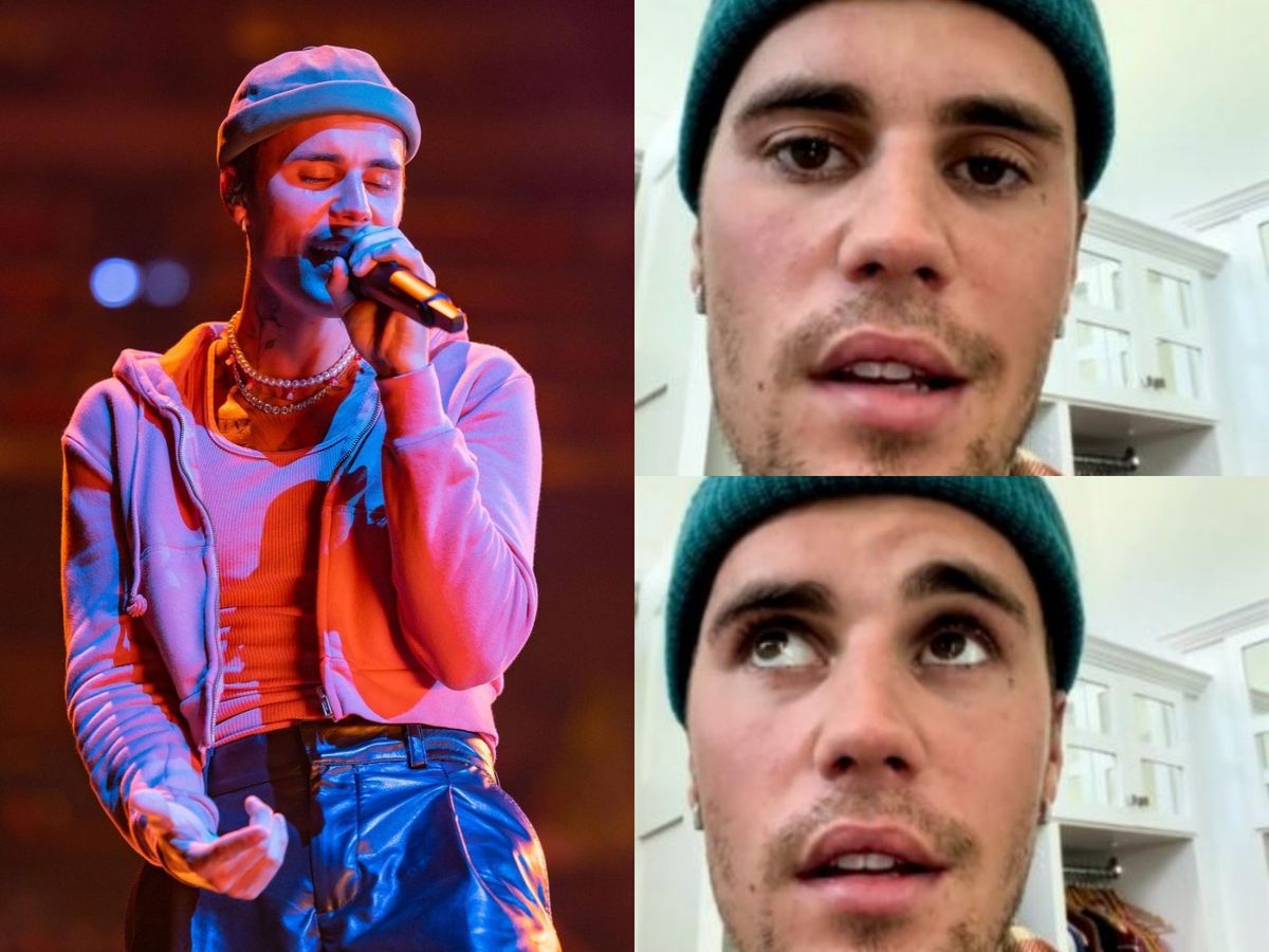 Justin Bieber, noi declarații după ce a dezvăluit că suferă de paralizie facială din cauza unui sindromului Ramsay Hunt