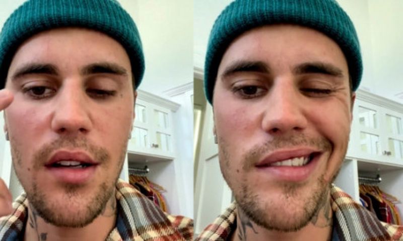 Justin Bieber, noi declarații după ce a dezvăluit că suferă de paralizie facială din cauza unui sindromului Ramsay Hunt