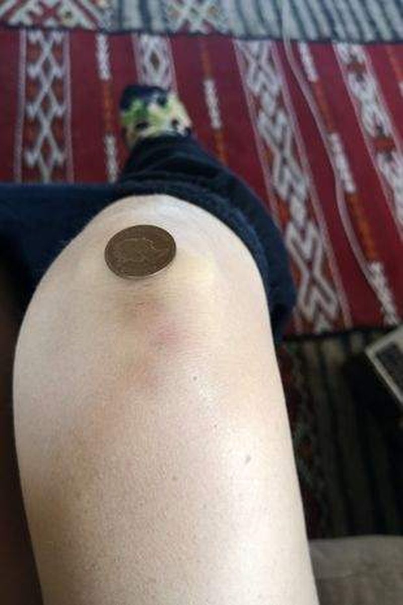 O femeie susține că a fost răpită de extratereștri de 52 de ori