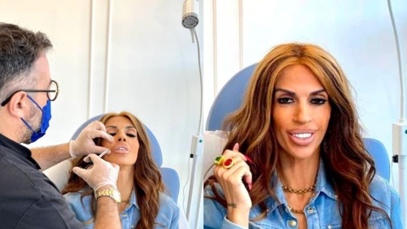 Raluca Bădulescu a ajuns, din nou, pe m&acirc;na medicului estetician: &bdquo;&Icirc;mi doream să scap de această problemă&rdquo;