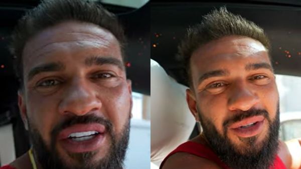 Dorian Popa, din nou pe mâna medicilor. Ce schimbare estetică vrea să-și facă artistul: „Am stabilit deja operația”