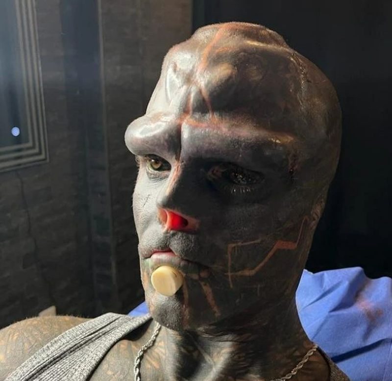 Unui bărbat i-a fost interzis sa intre în unele restaurante din cauza aspectului său fizic.