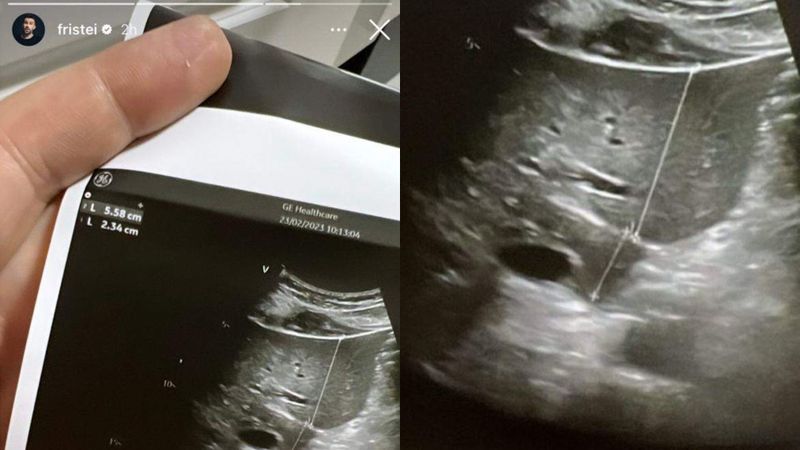 Florin Ristei și Naomi Hedman vor deveni părinți