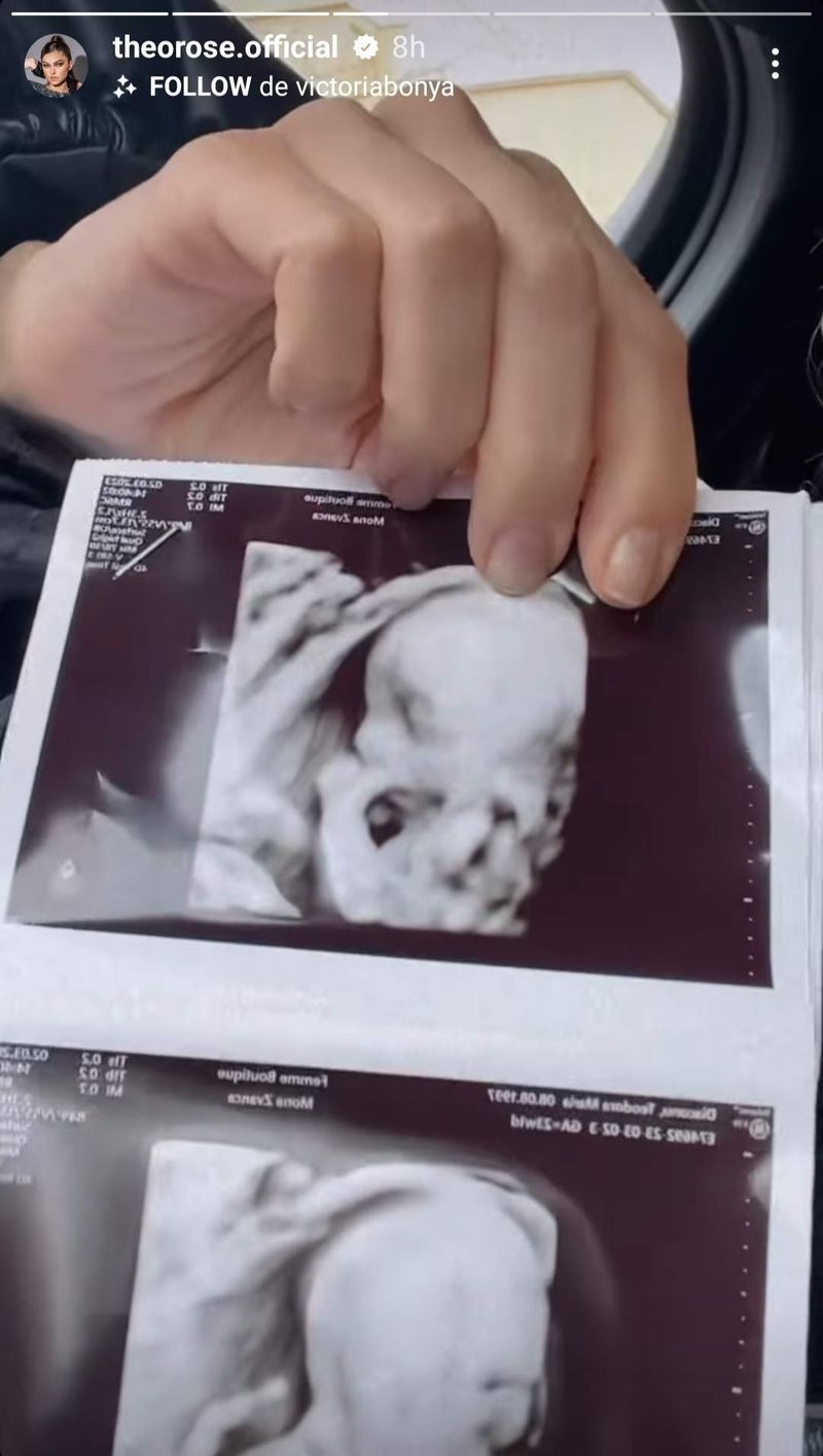 Theo Rose a postat ecografia bebelușului.