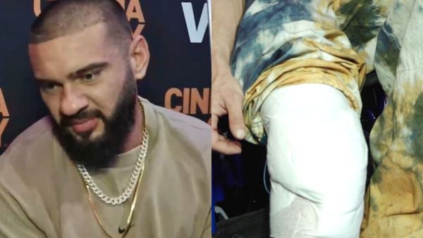 Dorian Popa, despre operația la genunchi. Artistul este „dezamăgit” că genunchii operați nu au tăieturi simetrice: ”Iar l-am surprins pe domnul doctor!”