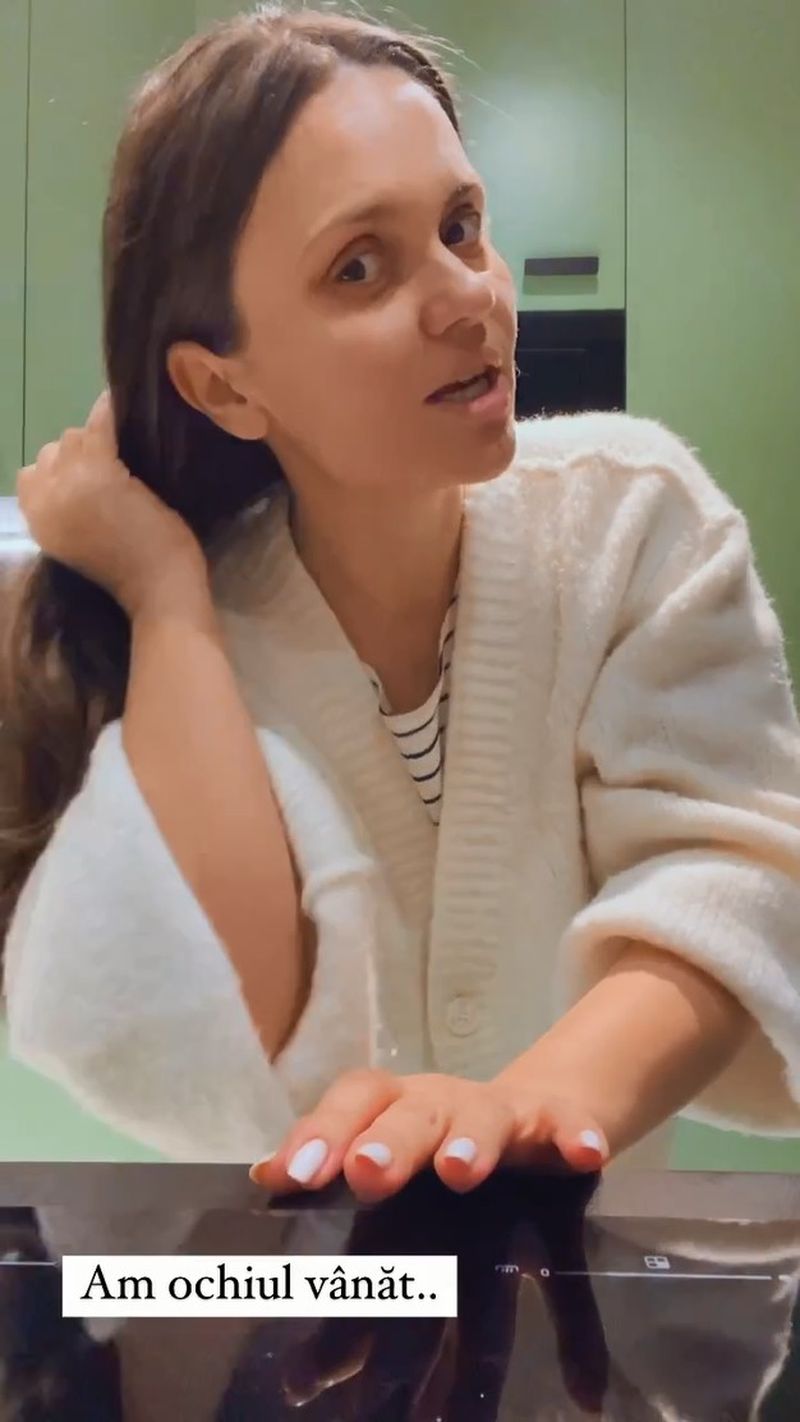 Cristina Siscanu a aparut cu ochiul vanat