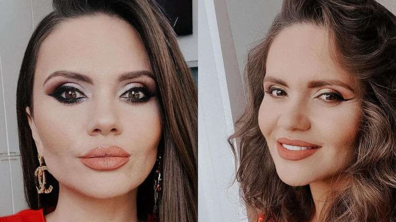 Cristina Șișcanu, apariție șocantă &icirc;n social media. Soția lui Madalin Ionescu are ochiul v&acirc;nat: "Nu suportam nimic"