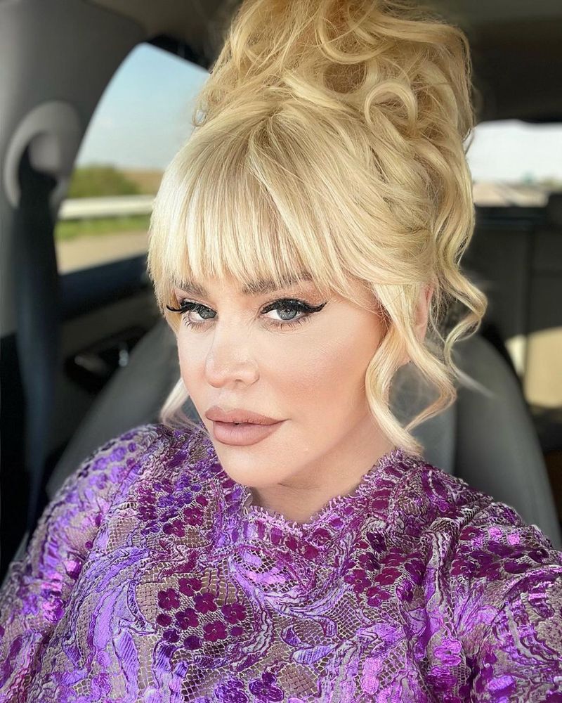 Adevărul despre operațiile estetice ale Loredanei Groza