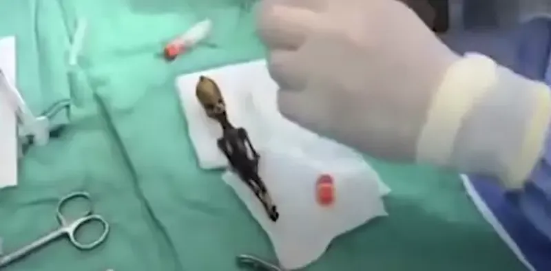 Misterul scheletului de „extraterestru” de 15 centimetri a fost în sfârșit rezolvat după ani de dezbateri