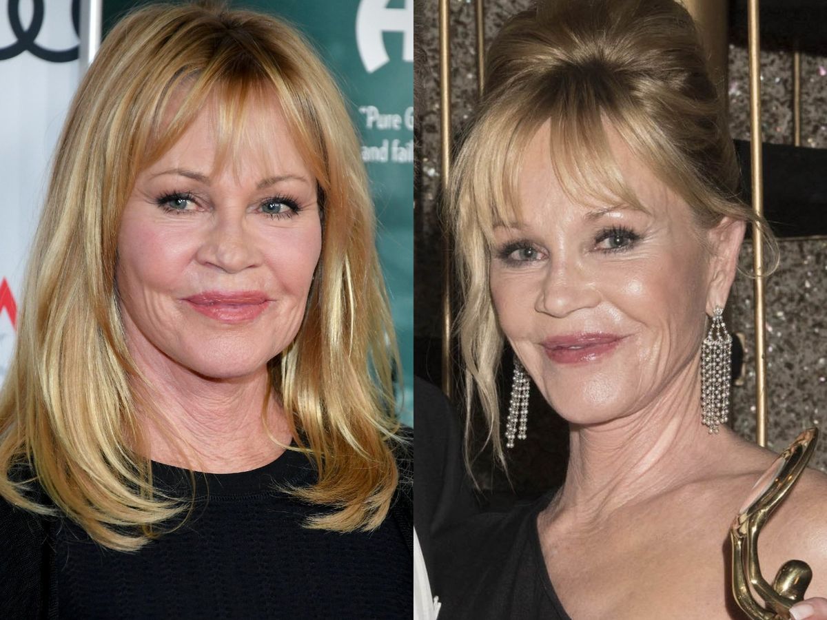 Melanie Griffith, surprinsă de paparazzi cu răni pe față și vânătăi pe mâini