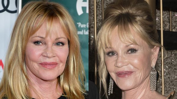 Imaginile cu Melanie Griffith care au provocat îngrijorare în rândul fanilor. Celebra actriță, surprinsă de paparazzi cu răni pe față și vânătăi pe mâini
