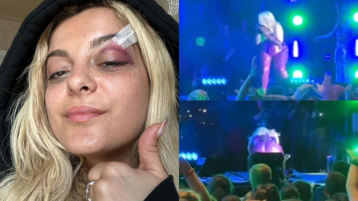 Bebe Rexha, lovită &icirc;n față cu un telefon mobil